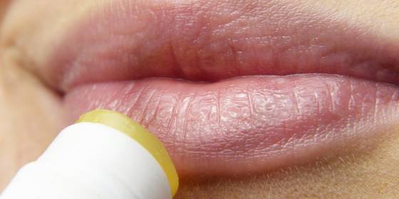 Labbra screpolate e labbra secche come porre rimedio con cure immediate