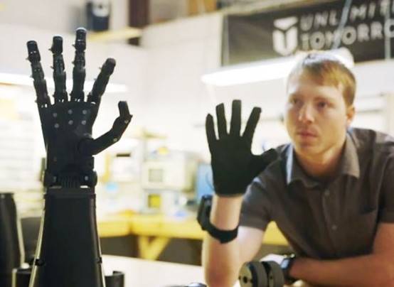 La Protesi Robotica del Giovanissimo Genio Easton LaChapelle